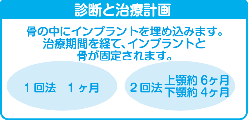 骨の中にインプラントを埋め込みます。治療期間を経て、インプラントと骨が固定されます。